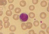 lymphocyte‎