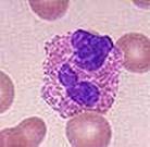 eosinophil‎